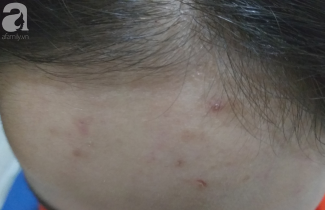 Hà Nội: Nữ sinh lớp 9 tố bị vợ hai của bố đập đầu, đánh tới mức phải nhập viện - Ảnh 7. Hà Nội: Nữ sinh lớp 9 tố bị vợ hai của bố đập đầu, đánh tới mức phải nhập viện - Ảnh 7.