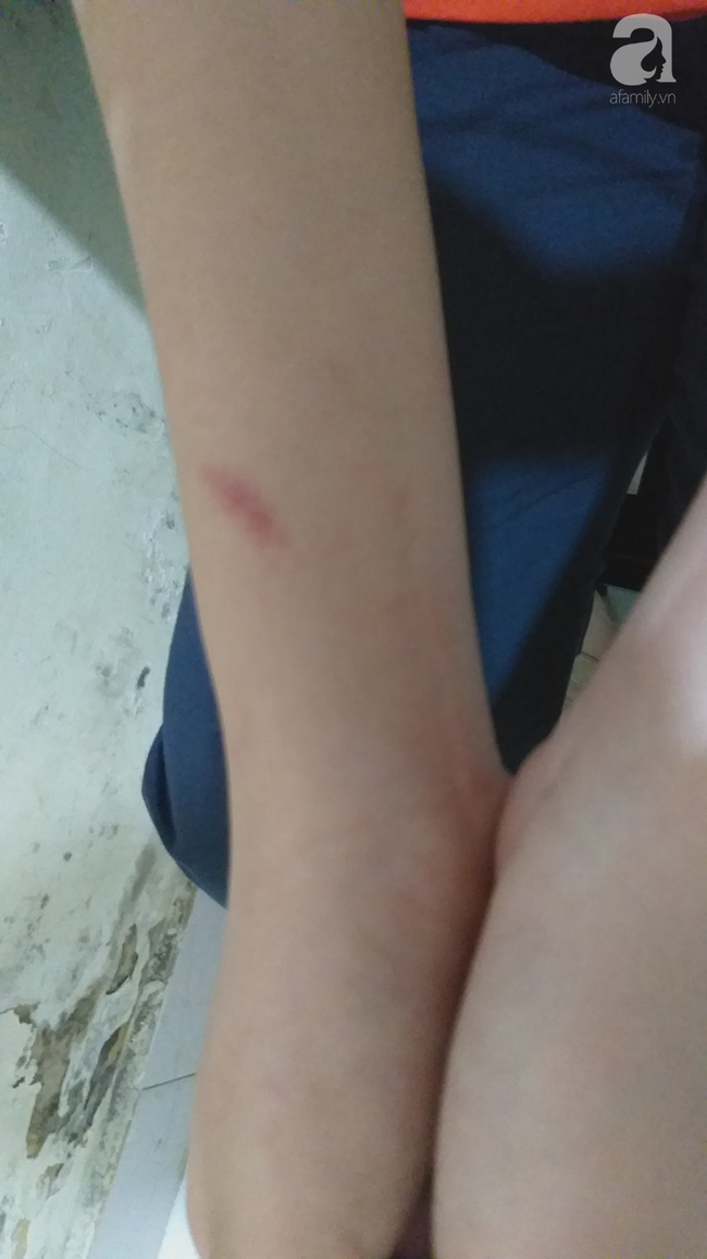 Hà Nội: Nữ sinh lớp 9 tố bị vợ hai của bố đập đầu, đánh tới mức phải nhập viện - Ảnh 8. Hà Nội: Nữ sinh lớp 9 tố bị vợ hai của bố đập đầu, đánh tới mức phải nhập viện - Ảnh 8.