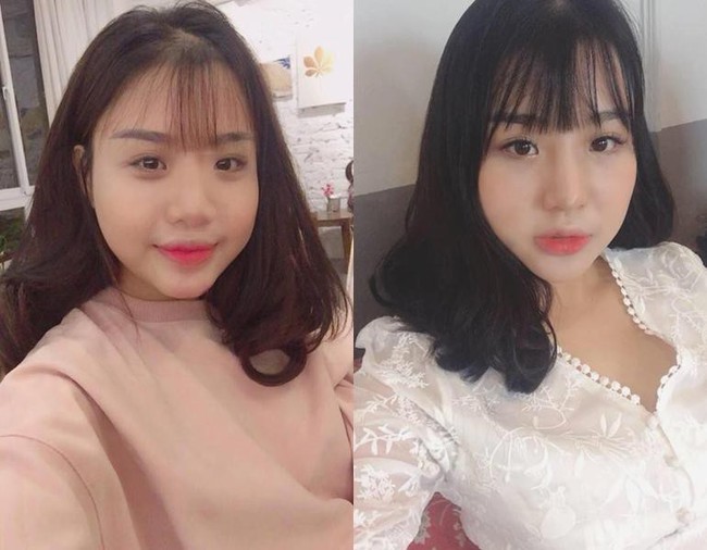 Mượn ảnh người khác để khoe nhan sắc sau phẫu thuật, cô gái nhận cái kết đắng khi bị vạch mặt giữa chốn đông người - Ảnh 2. Mượn ảnh người khác để khoe nhan sắc sau phẫu thuật, cô gái nhận cái kết đắng khi bị vạch mặt giữa chốn đông người - Ảnh 2.