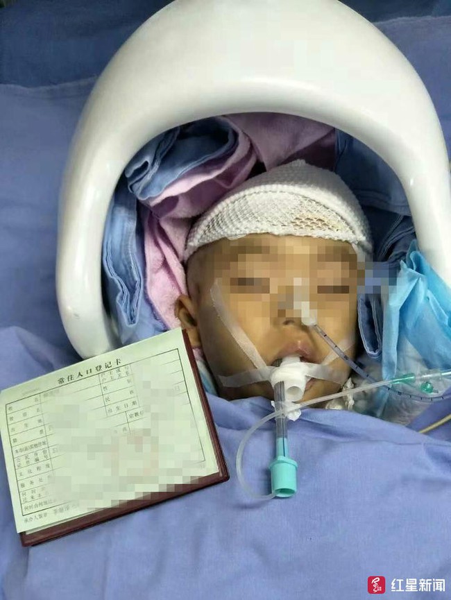 Bé gái 4 tuổi bị bại não, hôn mê sâu chỉ vì chủ quan của người lớn khi trẻ té ngã - Ảnh 1.