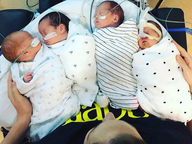 Ngắm 4 em bé đẹp tựa thiên thần trong ca sinh tư chào đời ở tuần thai thứ 29 - Ảnh 7.