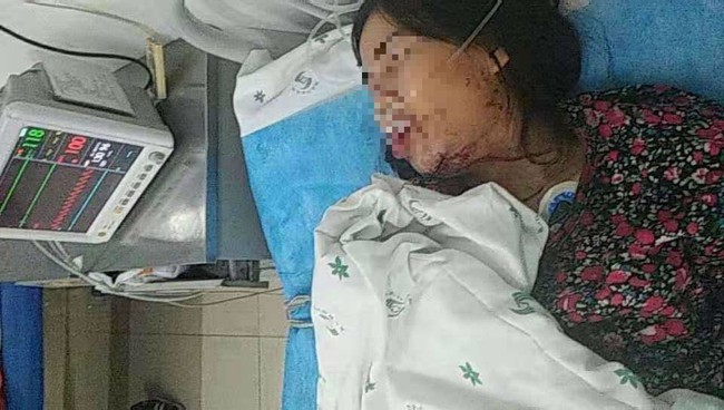 Sự thật về cô dâu Vĩnh Long nghi bị chồng Trung Quốc đánh đập chảy máu, nhập viện cấp cứu - Ảnh 1.