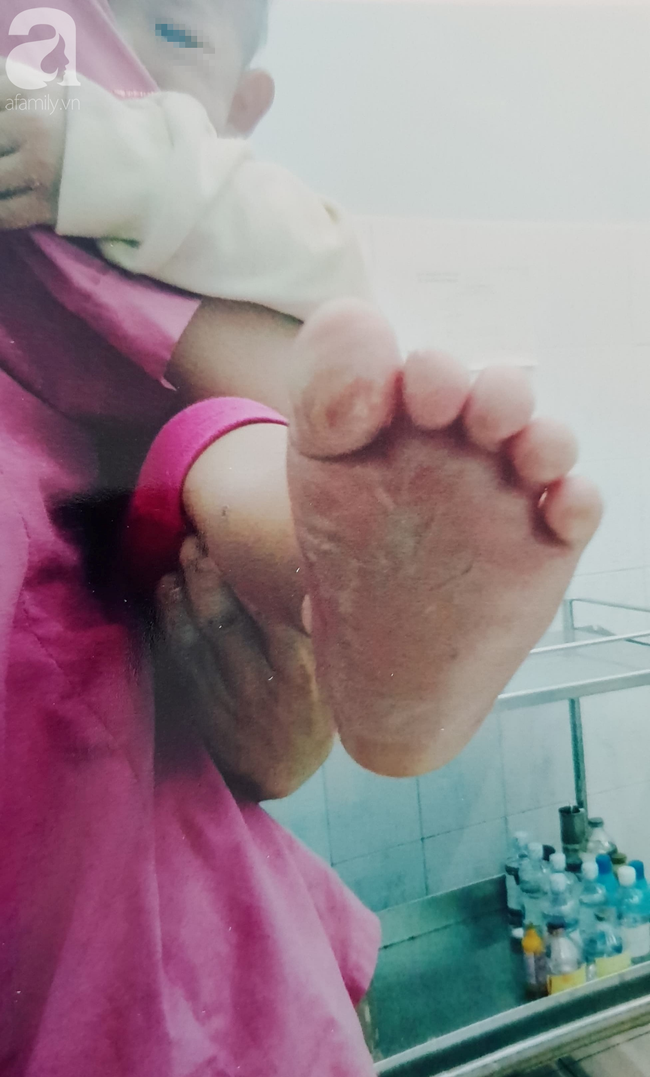 Cơ sở giữ trẻ lên tiếng việc bé gái 18 tháng tuổi bị phỏng ở chân: Không ai nhúng chân bé vào nước sôi - Ảnh 3.