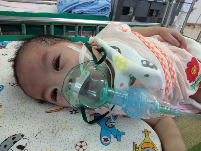 Bé gái 8 tháng tuổi sống phụ thuộc vào máy thở, chưa một lần được bú sữa mẹ vừa qua đời - Ảnh 1.