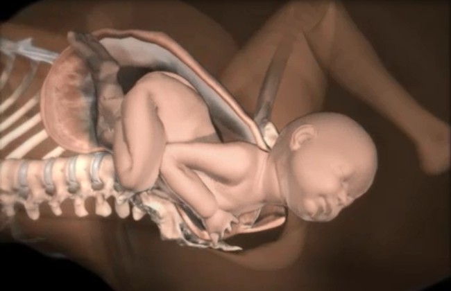 Những điều các mẹ cần biết về tình huống đẻ khó do bé bị kẹt vai trong lúc sinh thường - Ảnh 6.