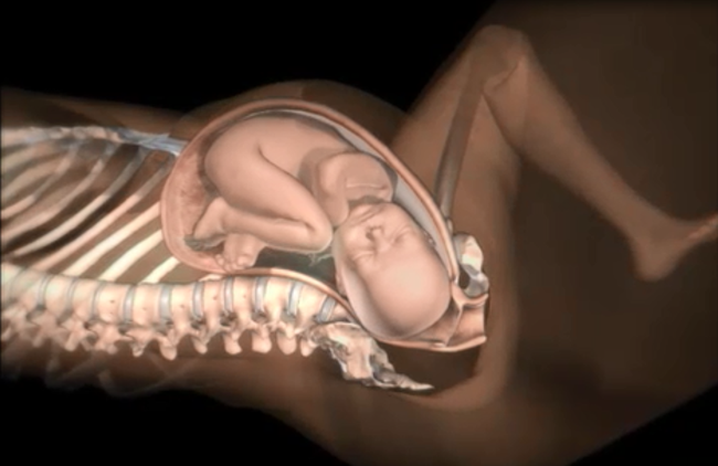 Những điều các mẹ cần biết về tình huống đẻ khó do bé bị kẹt vai trong lúc sinh thường - Ảnh 5.
