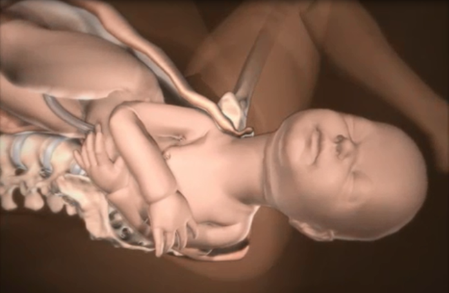 Những điều các mẹ cần biết về tình huống đẻ khó do bé bị kẹt vai trong lúc sinh thường - Ảnh 8.