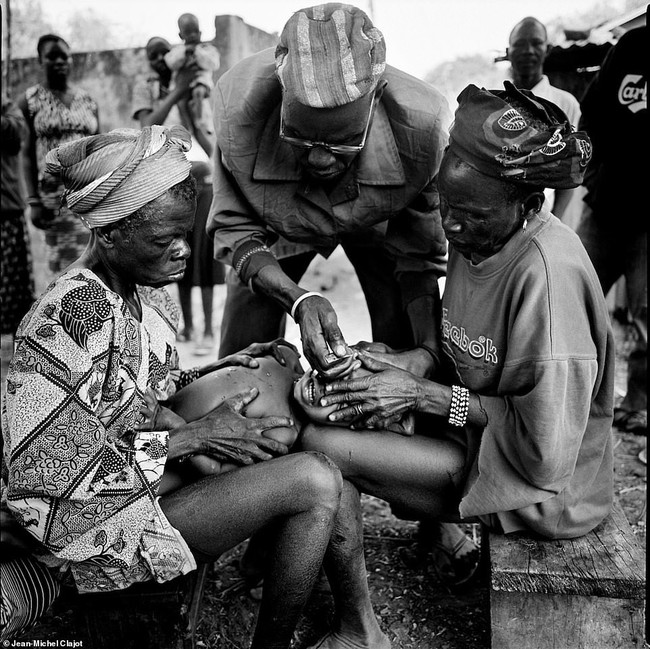 Tục lệ khắc dấu lên đầu trẻ em để đánh dấu thành viên gia tộc ở Châu Phi khiến ai chứng kiến cũng rùng mình - Ảnh 3.