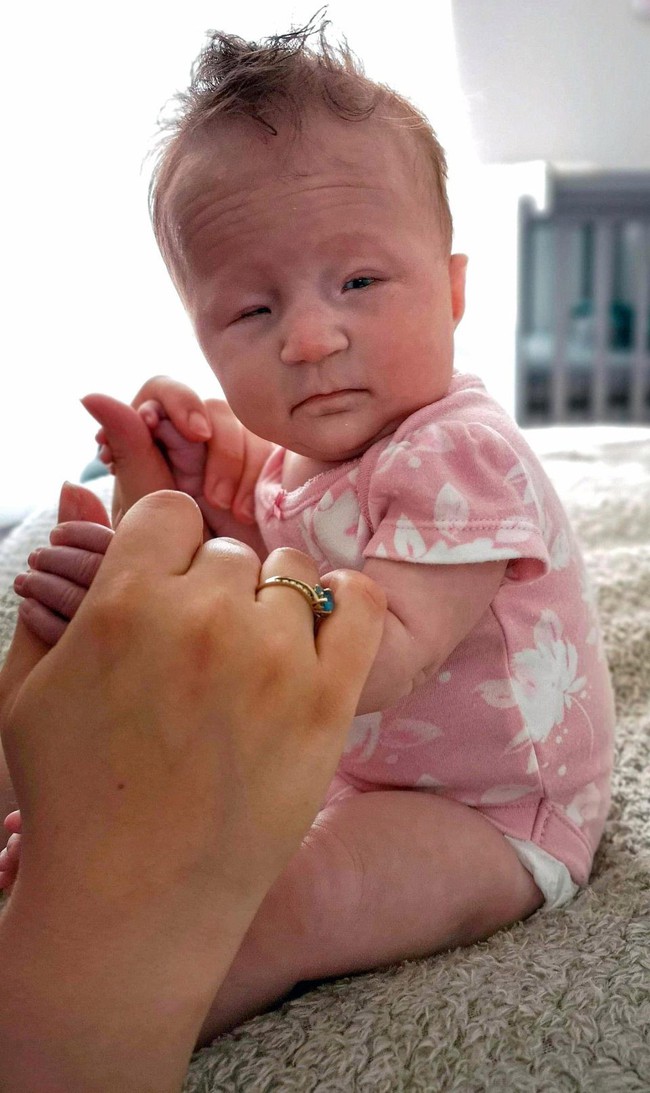 Bé sinh được 5 ngày nhưng mắt vẫn nhắm nghiền, bố mẹ tá hỏa khi biết con mắc chứng rối loạn di truyền hiếm gặp gây mù mắt - Ảnh 1.
