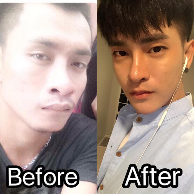 Đi bán giày rong để tích cóp tiền phẫu thuật thẩm mỹ, thanh niên Thái Lan trở thành biểu tượng của sự cố gắng vì cái đẹp - Ảnh 1. Đi bán giày rong để tích cóp tiền phẫu thuật thẩm mỹ, thanh niên Thái Lan trở thành biểu tượng của sự cố gắng vì cái đẹp - Ảnh 1.