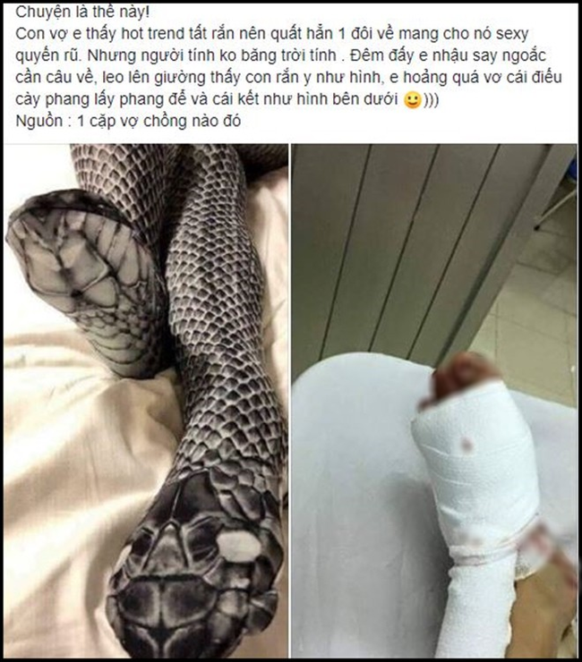 Sự thật đằng sau câu chuyện vợ trẻ bị chồng đánh nát chân vì đi tất hình rắn sexy - Ảnh 1.
