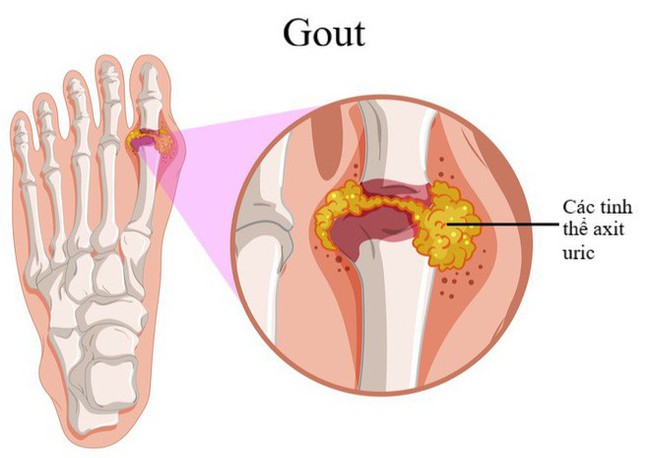 5 nhóm người không nên ăn cá để tránh gây hại lớn cho sức khỏe: Hãy xem có bạn không? - Ảnh 2.