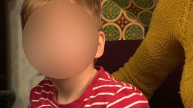 Đi phẫu thuật tinh hoàn ẩn, bé trai 2 tuổi đã bị hỏng luôn cả 2 bên do nhầm lẫn khủng khiếp của bác sĩ - Ảnh 2.