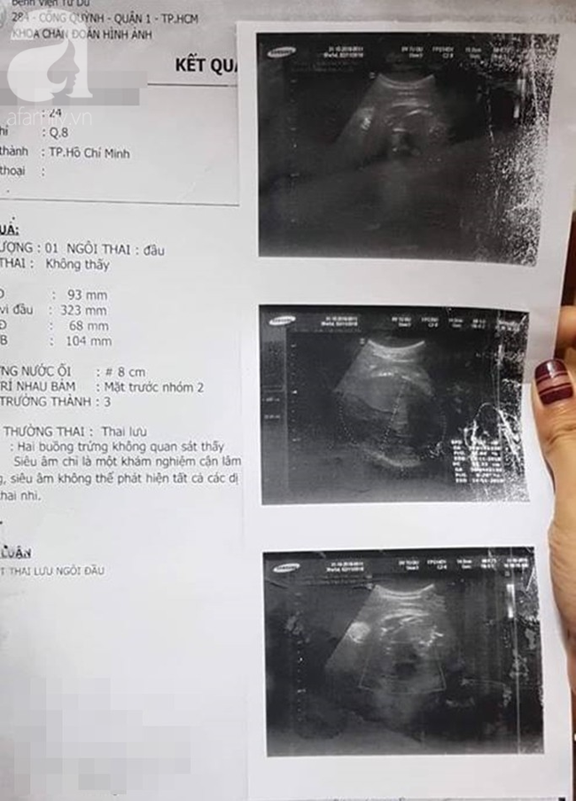 TP.HCM: Thai phụ 24 tuổi tố bác sĩ bệnh viện Từ Dũ tắc trách làm mất con trai đầu lòng - Ảnh 7.