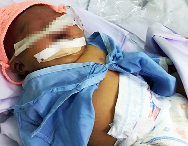Bé gái nặng 4kg nhưng cho sinh thường ở Bình Thuận bị tổn thương thần kinh cánh tay và hôn mê - Ảnh 2.