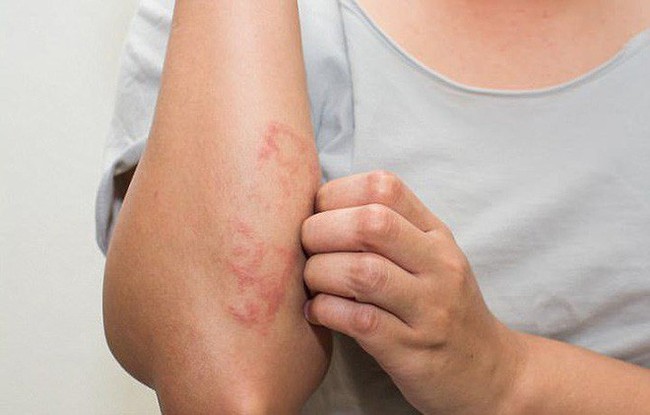 Trẻ dưới 10 tuổi mắc bệnh này sẽ bị giảm 20 năm tuổi thọ: Cha mẹ hãy chú ý phòng ngừa đúng - Ảnh 3. Trẻ dưới 10 tuổi mắc bệnh này sẽ bị giảm 20 năm tuổi thọ: Cha mẹ hãy chú ý phòng ngừa đúng - Ảnh 3.