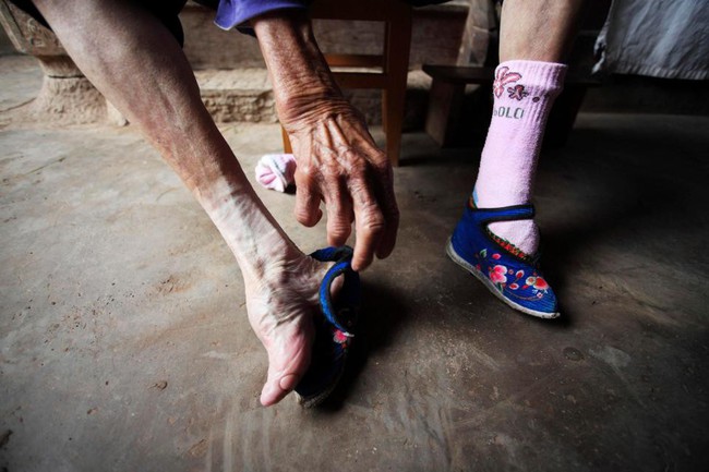 Tục Bó chân gót sen của Trung Quốc xưa: Hình ảnh những đôi chân rỉ máu và biến dạng khiến phụ nữ thời nay phải nín thở nổi da gà - Ảnh 6.