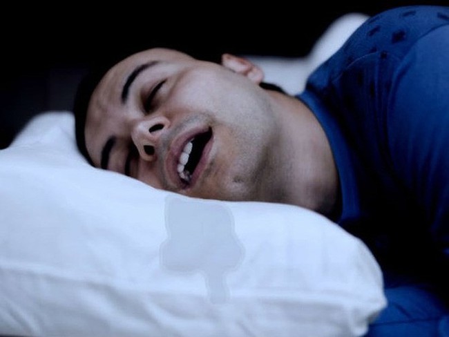Chảy nước dãi khi ngủ: Dấu hiệu cảnh báo bệnh nguy hiểm - Ảnh 1.