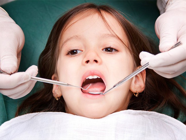 Bé gái 7 tuổi bị ung thư miệng, bác sĩ cảnh báo cha mẹ cần chú ý trong việc chăm sóc răng miệng cho trẻ - Ảnh 3.