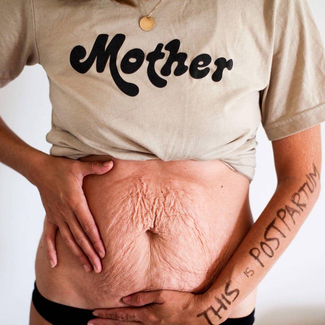 Những bức ảnh cho thấy cơ thể phụ nữ đã bị thay đổi khủng khiếp như thế nào sau khi sinh  - Ảnh 27.