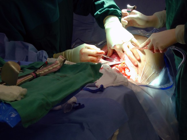 Bà mẹ đã nghĩ ra cách cực hay ho đáp trả lại quan niệm sinh mổ là không sinh con thực sự, làm mẹ thất bại - Ảnh 2. Bà mẹ đã nghĩ ra cách cực hay ho đáp trả lại quan niệm sinh mổ là không sinh con thực sự, làm mẹ thất bại - Ảnh 2.