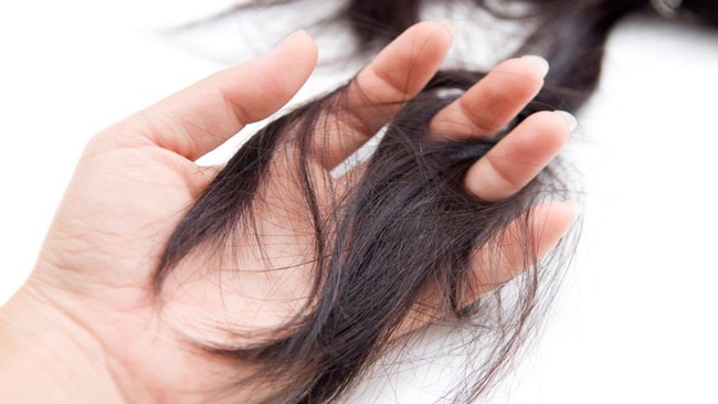 Thoát khỏi tình trạng vuốt tóc thôi cũng ra cả búi với 6 loại dầu gội ngăn rụng tóc được các chuyên gia đánh giá rất cao trên Amazon - Ảnh 2.