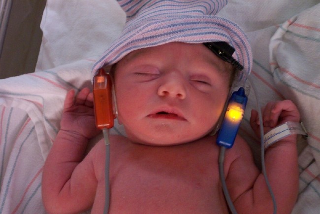 Đây là lý do bác sĩ khuyến nghị mọi đứa trẻ nên được kiểm tra thính lực ngay khi chào đời - Ảnh 2.