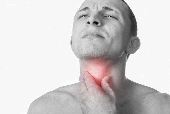 Nếu dấu hiệu chết người này không hết sau 2 - 3 tuần, hãy cẩn trọng với ung thư cổ họng - Ảnh 2. Nếu dấu hiệu chết người này không hết sau 2 - 3 tuần, hãy cẩn trọng với ung thư cổ họng - Ảnh 2.
