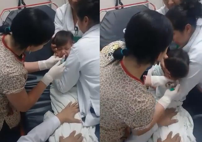 Clip: Không cần mổ xẻ hay gây mê, bác sĩ lôi bật đồng xu kẹt ở cổ họng bé chỉ trong 2 phút - Ảnh 2. Clip: Không cần mổ xẻ hay gây mê, bác sĩ lôi bật đồng xu kẹt ở cổ họng bé chỉ trong 2 phút - Ảnh 2.