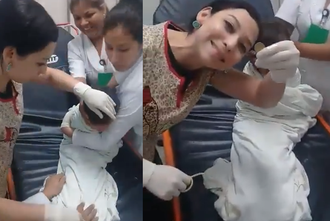 Clip: Không cần mổ xẻ hay gây mê, bác sĩ lôi bật đồng xu kẹt ở cổ họng bé chỉ trong 2 phút - Ảnh 3. Clip: Không cần mổ xẻ hay gây mê, bác sĩ lôi bật đồng xu kẹt ở cổ họng bé chỉ trong 2 phút - Ảnh 3.