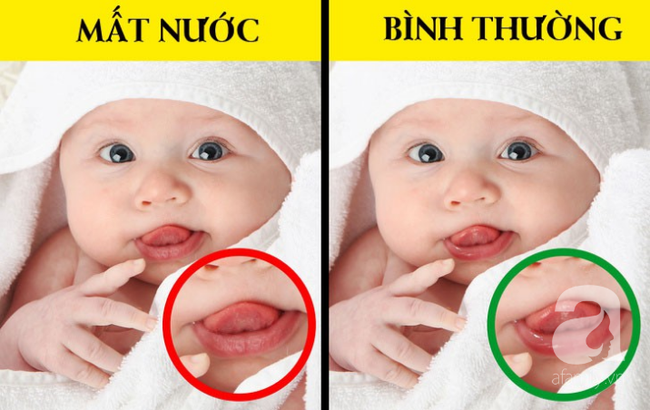 Giúp cha mẹ nhận biết và điều trị virus rota - căn bệnh khiến trẻ suy kiệt nhanh chóng - Ảnh 5.