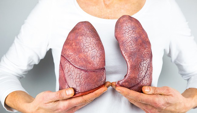 Ung thư phổi đang ngày càng trẻ hoá: đừng để đến lúc phát hiện thì đã quá muộn - Ảnh 4.