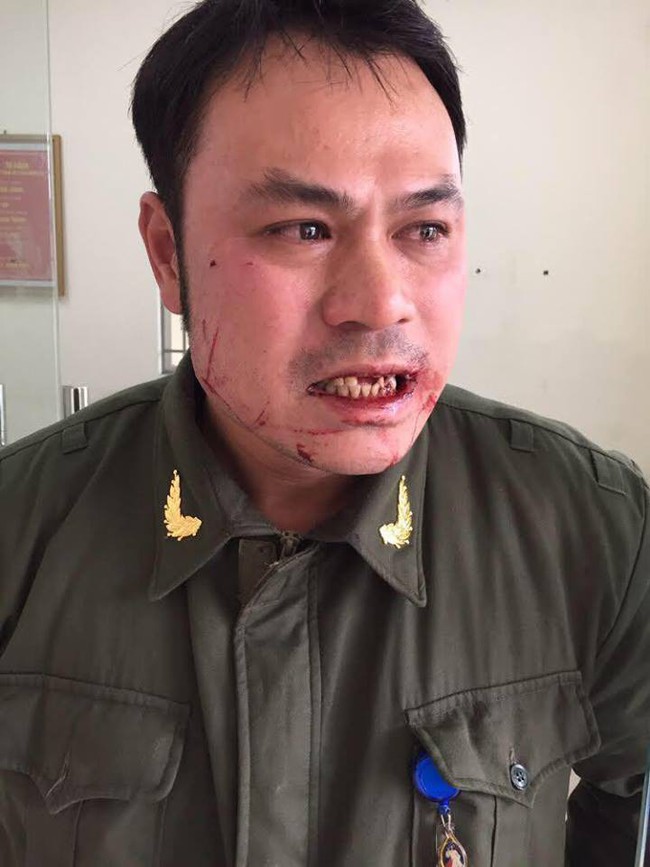 Tạm giữ một phụ nữ trong nhóm cò mồi  đánh nhân viên sân bay Nội Bài gãy 4 chiếc răng - Ảnh 1.