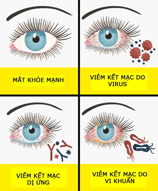 7 triệu chứng dị ứng nhưng chúng ta rất hay nhầm lẫn với bệnh khác nên dễ nguy hiểm nếu không điều trị đúng - Ảnh 4.