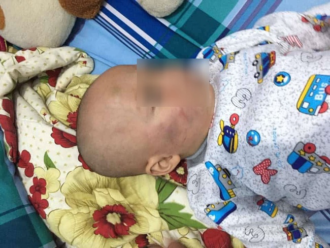Vĩnh Long: Phẫn nộ bé trai 19 tháng tuổi bị bảo mẫu tát liên tục vào mặt, phải nhập viện điều trị - Ảnh 4.