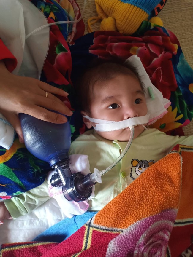 Ánh mắt cầu cứu của bé trai 8 tháng sống phụ thuộc vào máy thở: “Nếu ngừng bóp bình oxy con tôi sẽ ngưng thở” - Ảnh 1.