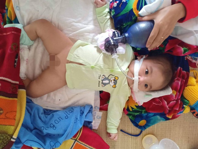 Ánh mắt cầu cứu của bé trai 8 tháng sống phụ thuộc vào máy thở: “Nếu ngừng bóp bình oxy con tôi sẽ ngưng thở” - Ảnh 2.