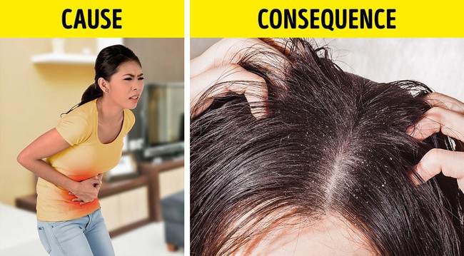Nếu gặp các biểu hiện này ở tóc, hãy gặp bác sĩ vì rất có thể có điều gì đó không ổn trong cơ thể - Ảnh 3.