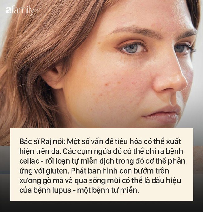 8 dấu hiệu cảnh báo bệnh được "khắc rất rõ" trên khuôn mặt của bạn - Ảnh 7. 8 dấu hiệu cảnh báo bệnh được "khắc rất rõ" trên khuôn mặt của bạn - Ảnh 7.