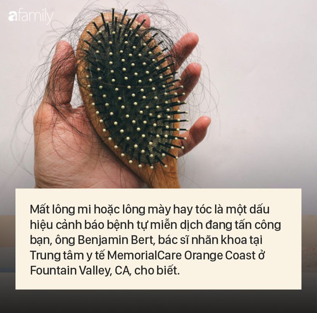 8 dấu hiệu cảnh báo bệnh được "khắc rất rõ" trên khuôn mặt của bạn - Ảnh 8. 8 dấu hiệu cảnh báo bệnh được "khắc rất rõ" trên khuôn mặt của bạn - Ảnh 8.