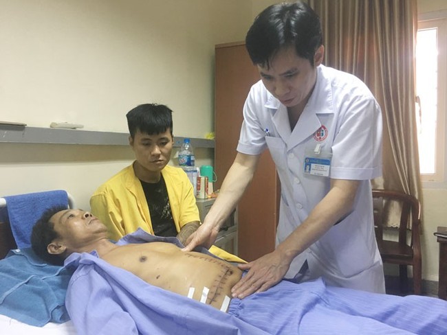 Mệt mỏi, ăn uống kém sút 9kg, tưởng sỏi đường mật nhưng đi khám mới phát hiện bị ung thư - Ảnh 1. Mệt mỏi, ăn uống kém sút 9kg, tưởng sỏi đường mật nhưng đi khám mới phát hiện bị ung thư - Ảnh 1.
