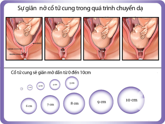 Mẹ nào cũng nói mở 10 phân sẽ đẻ nhưng không phải ai cũng biết mở 10 phân là như thế nào - Ảnh 8.