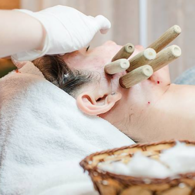 Hút mụn bằng ống tre đang rầm rộ tại các spa: Chuyên gia cảnh báo những ai muốn làm cần chú ý điều này - Ảnh 1.