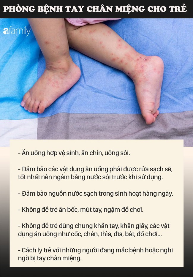 Bệnh tay chân miệng là một trong những dịch bệnh rất hay gặp ở trẻ em - Ảnh 2.