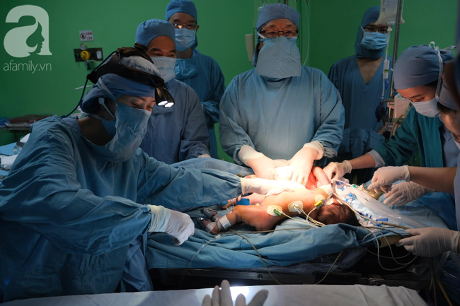TP.HCM: 18 bác sĩ phẫu thuật tách hai bé gái song sinh dính nhau phần gan, nhỏ nhất từ trước đến nay - Ảnh 4.