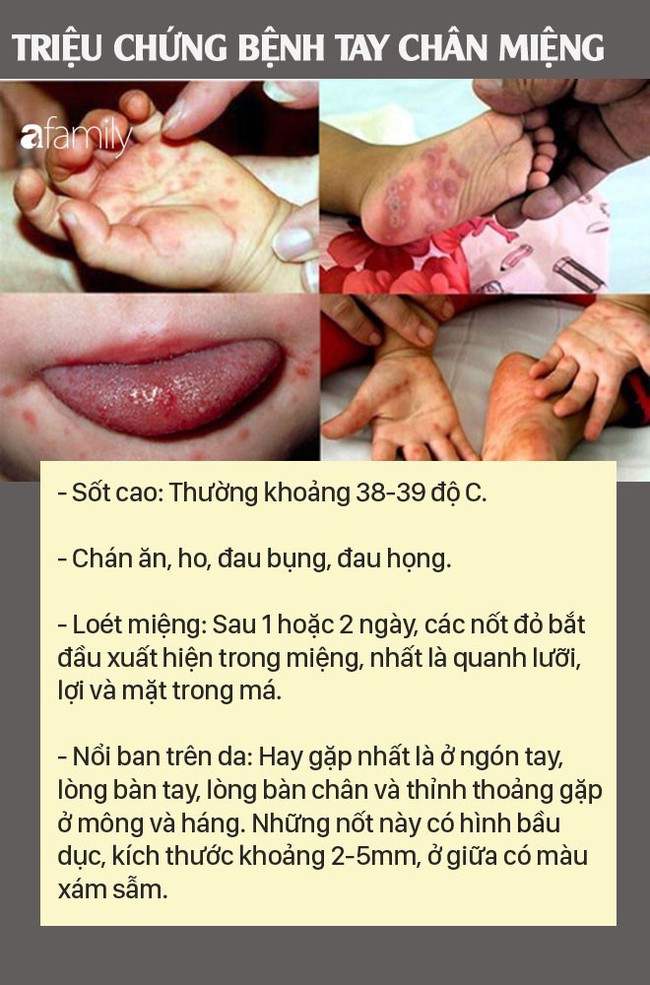 Những việc cha mẹ nào cũng nên làm để phòng bệnh tay chân miệng cho con - Ảnh 1.