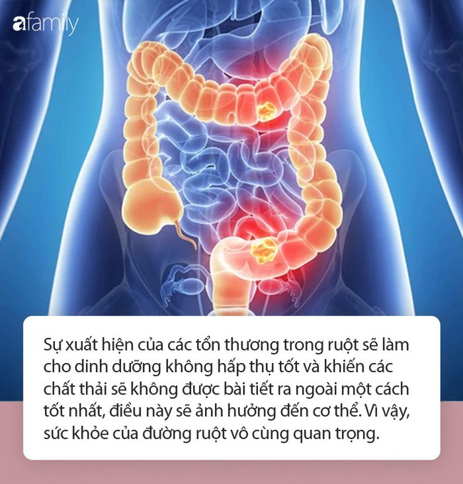 Cơ thể có 4 dấu hiệu này chứng tỏ đường ruột của bạn rất sạch - Ảnh 1.