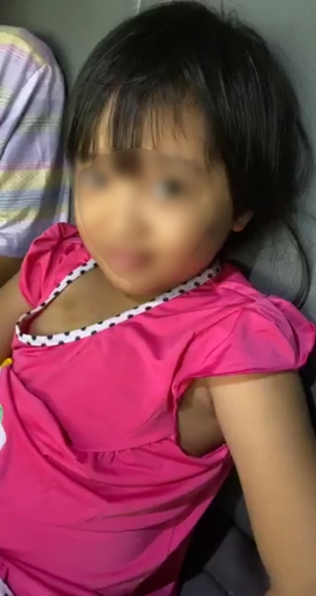 Đưa bé gái 6 tuổi nghi bị nhân tình của mẹ bạo hành, dùng tàn thuốc châm vào vùng kín đi giám định thương tật - Ảnh 1.