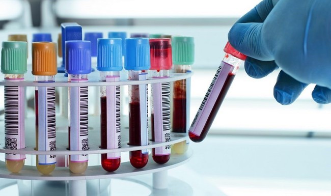 Sốt xuất huyết vẫn tiếp tục hoành hành, đây là 3 cơ sở xét nghiệm máu tại nhà uy tín giúp bạn tiết kiệm nhiều thời gian hơn - Ảnh 1.