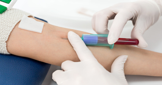 Sốt xuất huyết vẫn tiếp tục hoành hành, đây là 3 cơ sở xét nghiệm máu tại nhà uy tín giúp bạn tiết kiệm nhiều thời gian hơn - Ảnh 3.